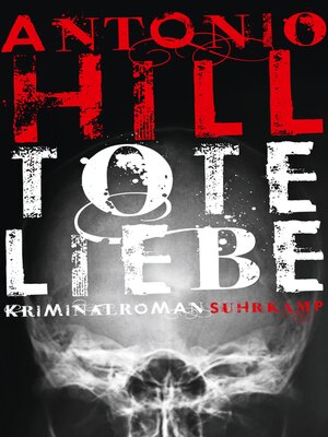 cover image of Tote Liebe